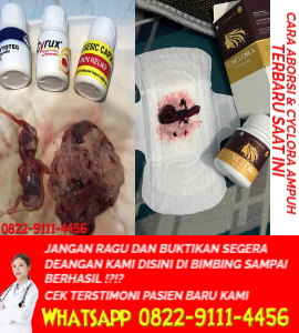 cara-menggugurkan-kandungan-dengan-obat-abors.jpg